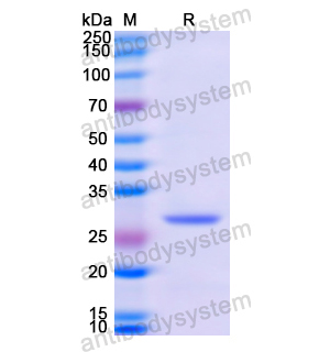 Recombinant Human GSTM3, N-His