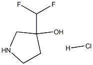 3-(difluoromethyl)pyrrolidin-3-ol hydrochloride Structure