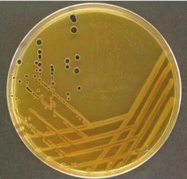 Salmonella-shigella agar medium(SS).jpg