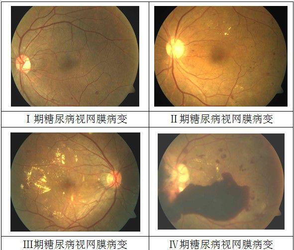 羟苯磺酸钙产品介绍 