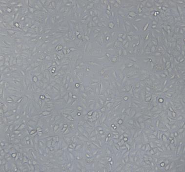 NIH:OVCAR-3人卵巢癌细胞