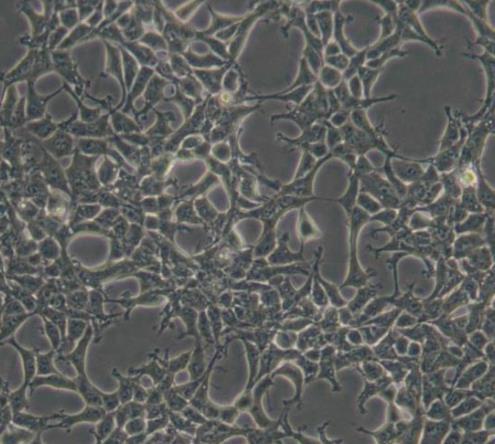 人胚肾细胞