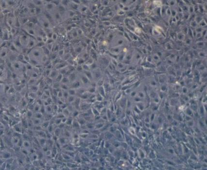 SVEC4-10(小鼠淋巴结内皮细胞)