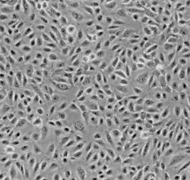 HCC827 人非小细胞肺癌细胞