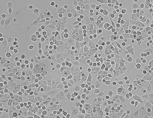 HCCLM3人高转移肝癌细胞的应用