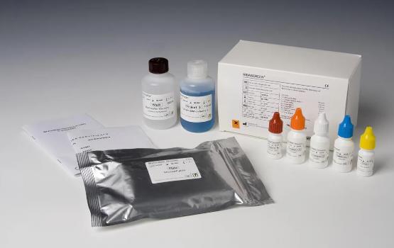 人抗内因子抗体(IFA)ELISA 试剂盒的应用