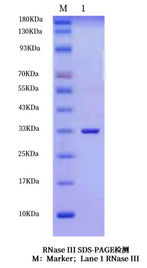 RNA酶III(RNASE III)的作用与应用