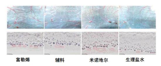 改善皮肤微循环系统