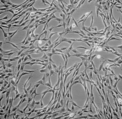 HuT 102细胞：人T淋巴瘤细胞系的应用