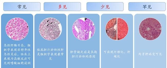 氯丙嗪的病理特点和损伤机制