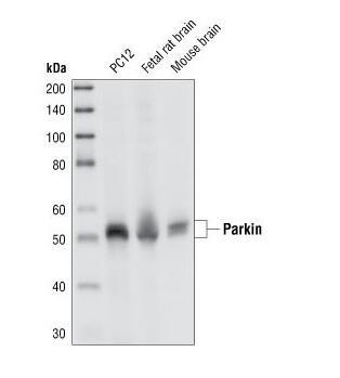 ParkinMouse mAb #4211---CST.jpg