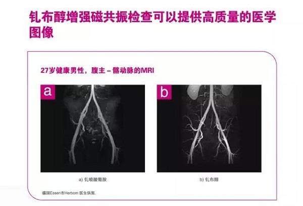 钆布醇核磁显影