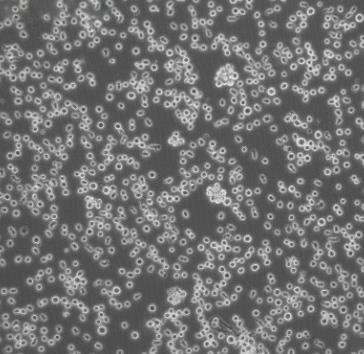 SUPB15细胞系|人急性淋白血病细胞的应用