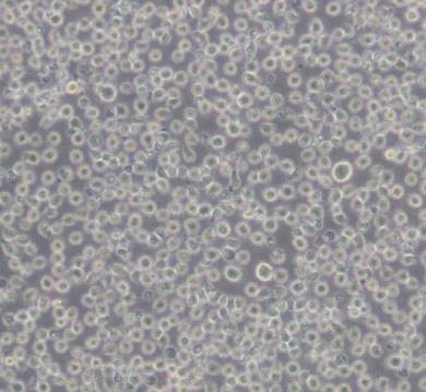 小鼠淋巴细胞白血病的应用