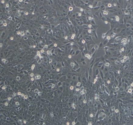NCI-H2227人小细胞肺癌贴壁细胞系.png