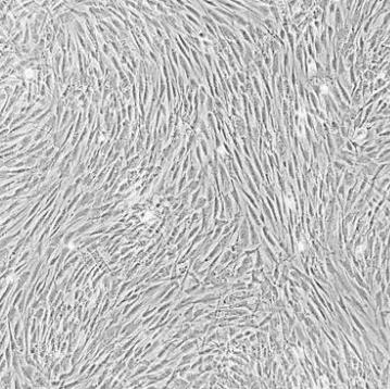 人骨髓间充质干细胞的应用