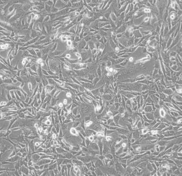 BALB/3T3CLONEA31 小鼠胚胎成纤维细胞的应用