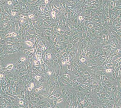 EMT6细胞系|小鼠乳腺癌细胞的应用