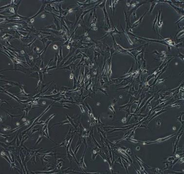 小鼠脂肪干细胞.png
