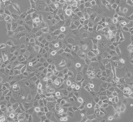 NCI-H69人小细胞肺癌贴壁细胞系.png