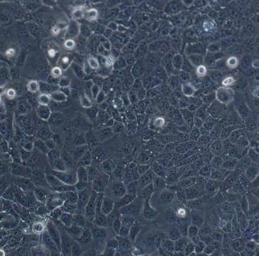THLE-2人肝永生化贴壁细胞系的应用