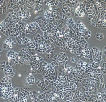 NCI-H226人肺鳞癌贴壁细胞系的应用