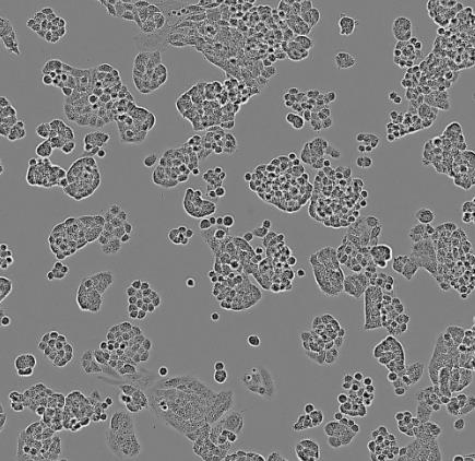 人肺鳞癌细胞的应用