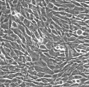 HPDE6-C7细胞系|人正常胰腺导管上皮细胞的应用