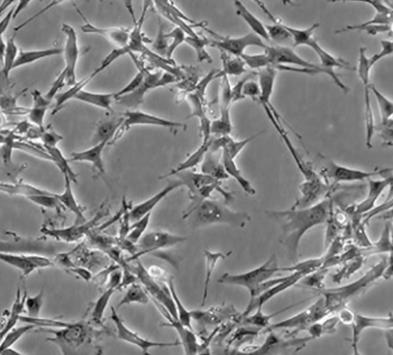 U-138MG 人脑神经胶质瘤细胞系的应用