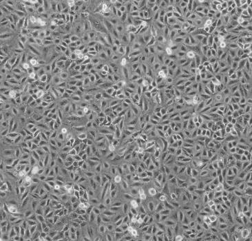 NCI-H719细胞系|人小细胞肺癌细胞的应用