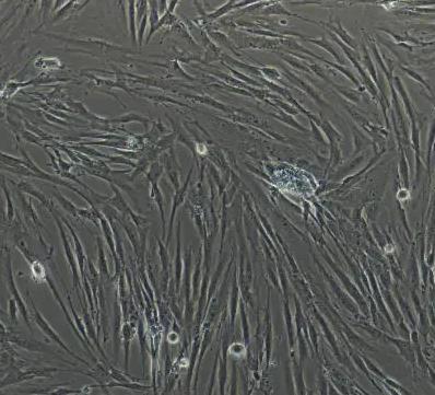 小鼠主动脉外膜成纤维细胞.png