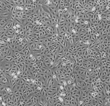 DMS79细胞系|人小细胞肺癌细胞的应用