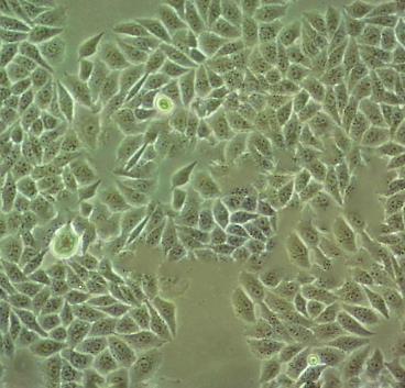 INS-1E细胞系|大鼠胰岛素瘤细胞的应用