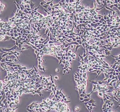 SNU-761人肝癌贴壁细胞系的应用