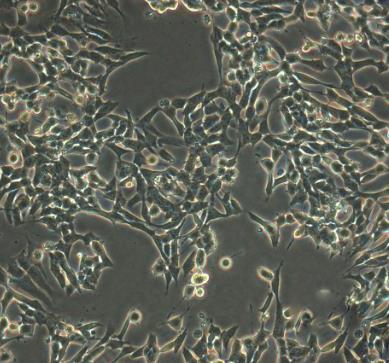 A101D人黑色素瘤贴壁细胞系.png