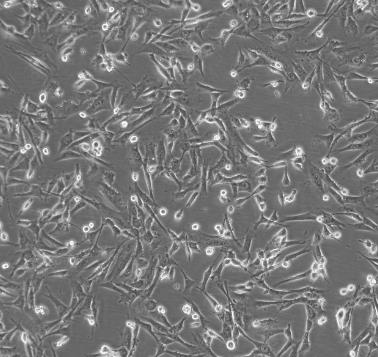 NCI-H378细胞系|人小细胞肺癌细胞的应用