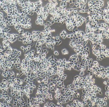 OVISE人卵巢癌贴壁细胞系的应用