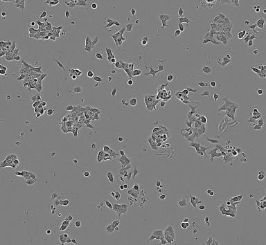 NCI-H82人小细胞肺癌贴壁细胞系.png