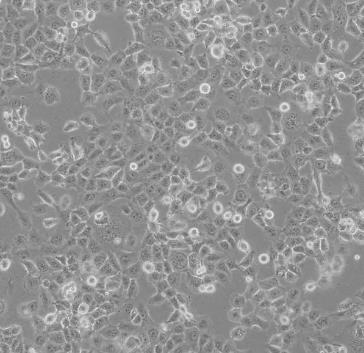 NCI-H841人小细胞肺癌贴壁细胞系的应用