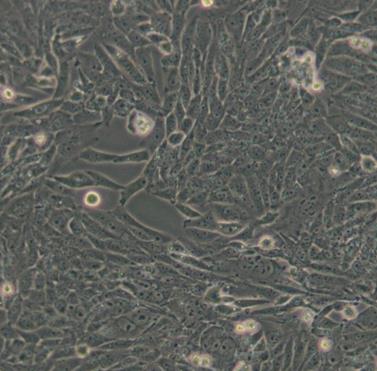 HTERT RPE-1细胞系|人视网膜色素上皮细胞的应用
