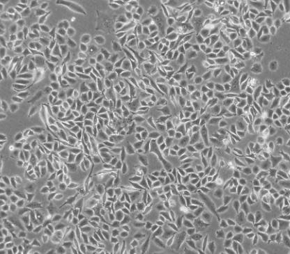 NCI-H498细胞系|人结直肠腺癌细胞的应用