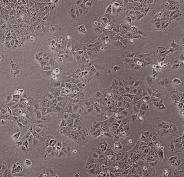 SNU-475人肝癌贴壁细胞系的应用