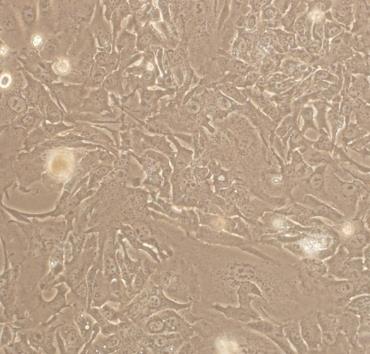 KYSE510细胞系|人食管鳞癌细胞的应用