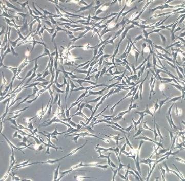 小鼠视网膜MULLER细胞.png