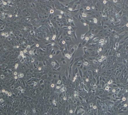 SW1271人肺腺癌贴壁细胞系.png