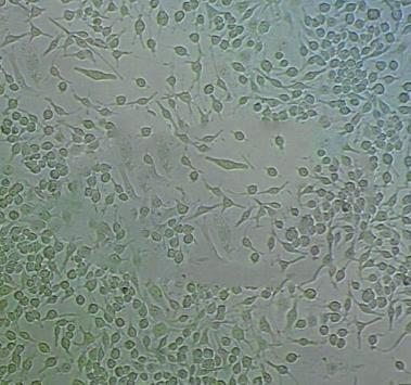 NCM356结直肠腺癌贴壁细胞系.png