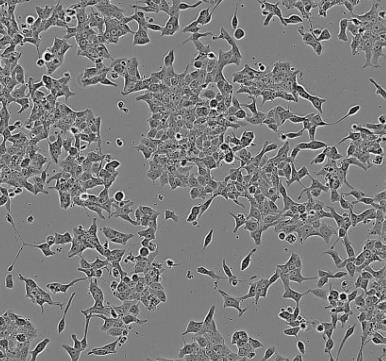 NCI-H660人小细胞癌贴壁细胞系.png