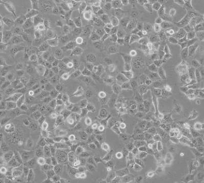 NCI-H2052人恶性胸膜间皮瘤贴壁细胞系的应用