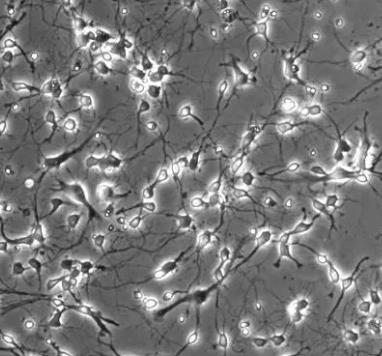 大鼠下丘脑神经元细胞的应用