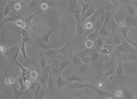 HTR-8/SVNEO 人绒毛膜滋养层细胞系
